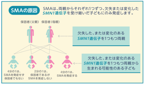 SMAの原因と遺伝子